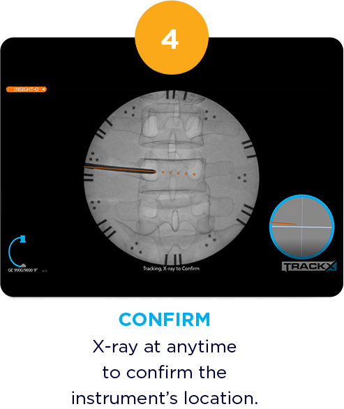 X-ray at anytime to confirm the instrument's location.
